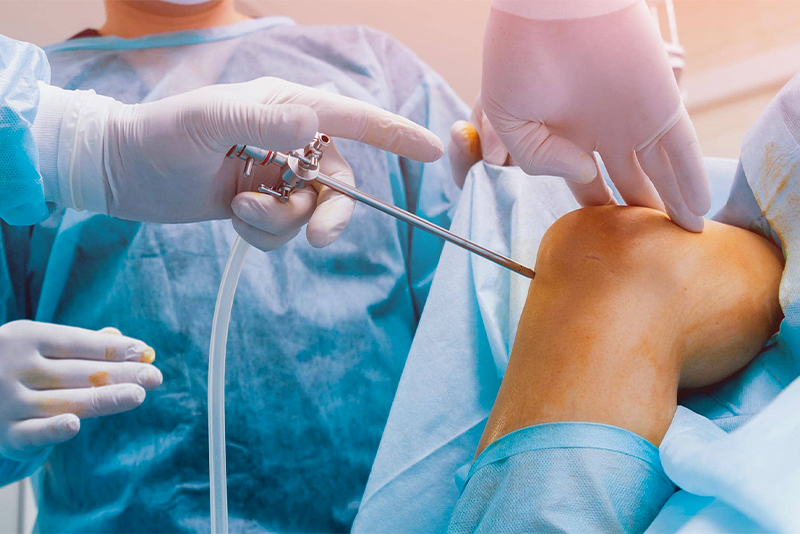 Chirurgie orthopédique Côte-d’Ivoire