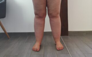 Jambes poteaux