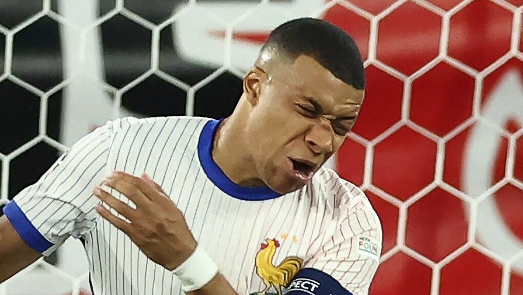 Nez cassé Comment savoir si fracture